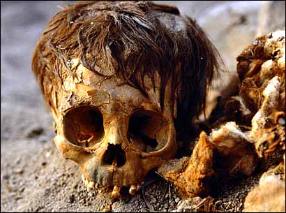 Cráneo de uno de los miles de restos humanos  recientemente hallados en Lima-Perú (1480-1535 AD)
